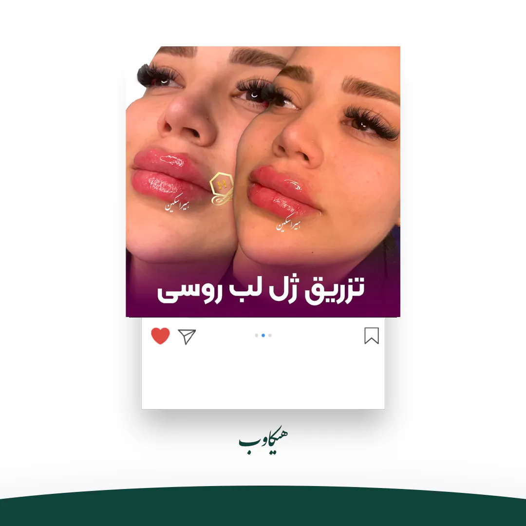 امور گرافیک کلینیک زیبایی هیر اسکین